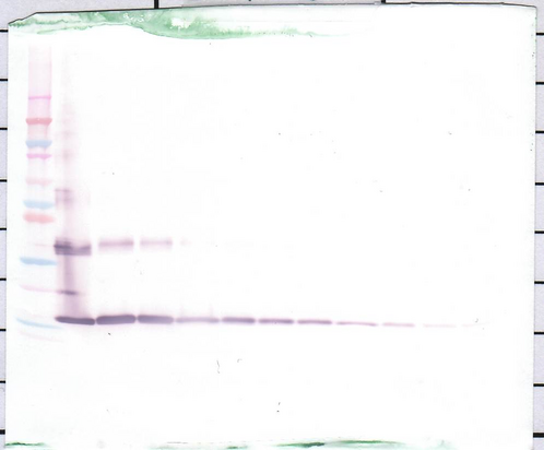 IL1F9 Antibody - Anti-Human IL-36? (IL-1F9) Western Blot Reduced