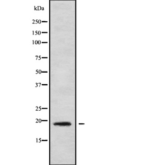 IL1F9 Antibody - Western blot analysis IL1F9 using COLO205 whole cells lysates