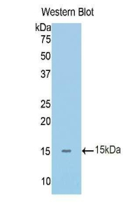 IL1R1 Antibody - Western blot of recombinant IL1RA / IL1R1.  This image was taken for the unconjugated form of this product. Other forms have not been tested.