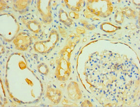IL1R1 Antibody - Immunohistochemistry of paraffin-embedded human kidney tissue using IL1R1 Antibody at dilution of 1:100