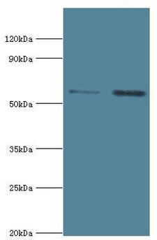 IL1R1 Antibody - Western blot. All lanes: Interleukin-1 receptor type 1 antibody at 6 ug/ml. Lane 1: HeLa whole cell lysate. Lane 2: mouse heart tissue. Secondary antibody: Goat polyclonal to rabbit at 1:10000 dilution. Predicted band size: 65 kDa. Observed band size: 65 kDa.