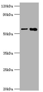 IL1R1 Antibody - Western blot All lanes: IL1R1 antibody at 6µg/ml Lane 1: Hela whole cell lysate Lane 2: Mouse heart tissue Secondary Goat polyclonal to rabbit IgG at 1/10000 dilution Predicted band size: 65 kDa Observed band size: 65 kDa