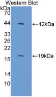 IL1R1 Antibody - WesternBlot;Sample:RecombinantIL1R1,Mouse.