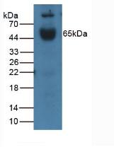 IL1R1 Antibody - Western Blot; Sample: Mouse Placenta Tissue.