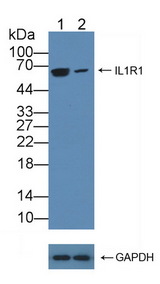 IL1R1 Antibody - Knockout Varification: Lane 1: Wild-type Raji cell lysate; Lane 2: IL1R1 knockout Raji cell lysate; Predicted MW: 65kd Observed MW: 65kd Primary Ab: 3µg/ml Rabbit Anti-Human IL1R1 Antibody Second Ab: 0.2µg/mL HRP-Linked Caprine Anti-Rabbit IgG Polyclonal Antibody