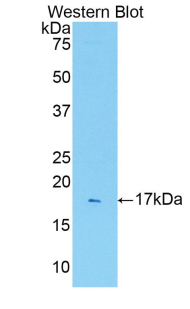 IL1R1 Antibody - Western blot of IL1R1 antibody.