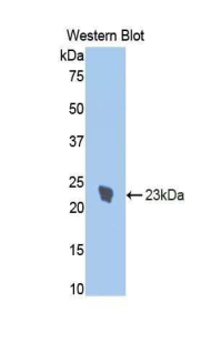 IL1R1 Antibody - Western blot of recombinant IL1RA / IL1R1.  This image was taken for the unconjugated form of this product. Other forms have not been tested.