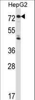 IL1R1 Antibody - IL1R1 Antibody western blot of HepG2 cell line lysates (35 ug/lane). The IL1R1 antibody detected the IL1R1 protein (arrow).