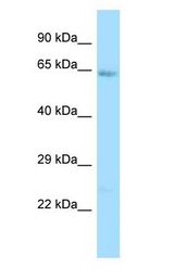 IL1R1 Antibody - IL1RA / IL1R1 antibody Western Blot of Fetal Heart.  This image was taken for the unconjugated form of this product. Other forms have not been tested.