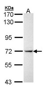 IL1R1 Antibody - Sample (30 ug of whole cell lysate). A: Molt-4. 7.5% SDS PAGE. IL1R1 antibody diluted at 1:5000