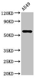 IL1R1 Antibody - Western Blot Positive WB detected in:A549 whole cell lysate All Lanes:IL1R1 antibody at 3µg/ml Secondary Goat polyclonal to rabbit IgG at 1/50000 dilution Predicted band size: 66 KDa Observed band size: 66 KDa