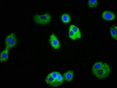 IL1R1 Antibody - Immunofluorescence staining of HepG2 cells with IL1R1 Antibody at 1:100, counter-stained with DAPI. The cells were fixed in 4% formaldehyde, permeabilized using 0.2% Triton X-100 and blocked in 10% normal Goat Serum. The cells were then incubated with the antibody overnight at 4°C. The secondary antibody was Alexa Fluor 488-congugated AffiniPure Goat Anti-Rabbit IgG(H+L).