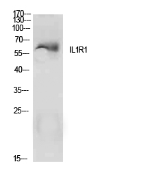 IL1R1 Antibody - Western blot analysis of extracts from MCF7 cells, using IL1R1 Antibody.