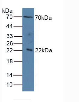 IL1RAP Antibody - Western Blot; Sample: Human Serum.