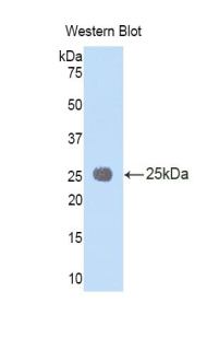 IL1RAP Antibody - Western blot of recombinant IL-1RAcP / IL1RAP.  This image was taken for the unconjugated form of this product. Other forms have not been tested.