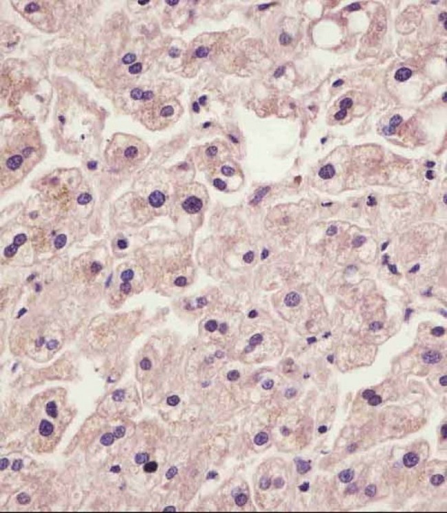 IL1RAP Antibody - IL1RAP Antibody (C-Term) staining IL1RAP in human liver tissue sections by Immunohistochemistry (IHC-P - paraformaldehyde-fixed, paraffin-embedded sections). Tissue was fixed with formaldehyde and blocked with 3% BSA for 0. 5 hour at room temperature; antigen retrieval was by heat mediation with a citrate buffer (pH6). Samples were incubated with primary antibody (1/25) for 1 hours at 37°C. A undiluted biotinylated goat polyvalent antibody was used as the secondary antibody.