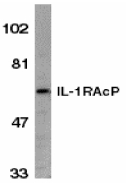 IL1RAP Antibody - Western blot of IL-1RAcP in HeLa whole cell lysate with IL-1RAcP antibody at 1:1000 dilution.