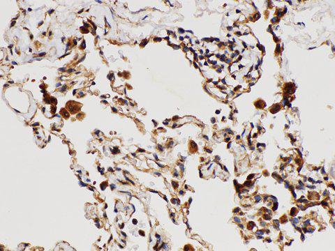IL1RAP Antibody - Immunohistochemistry of paraffin-embedded Human lung using IL1RAP Polycloanl Antibody at dilution of 1:150