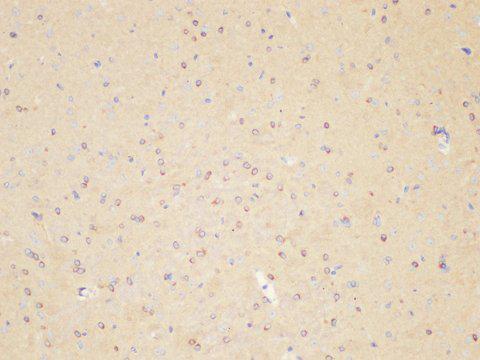 IL1RAP Antibody - Immunohistochemistry of paraffin-embedded Rat brain using IL1RAP Polycloanl Antibody at dilution of 1:200