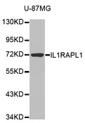 IL1RAPL1 Antibody - Western blot analysis of extracts of various cell lines, using IL1RAPL1 antibody.