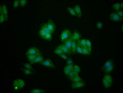 IL1RAPL1 Antibody - Immunofluorescence staining of HepG2 cells at a dilution of 1:133, counter-stained with DAPI. The cells were fixed in 4% formaldehyde, permeabilized using 0.2% Triton X-100 and blocked in 10% normal Goat Serum. The cells were then incubated with the antibody overnight at 4 °C.The secondary antibody was Alexa Fluor 488-congugated AffiniPure Goat Anti-Rabbit IgG (H+L) .