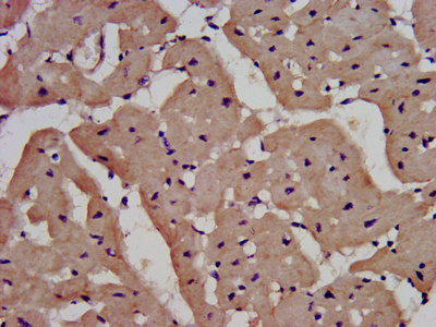IL1RAPL1 Antibody - Immunohistochemistry image at a dilution of 1:400 and staining in paraffin-embedded human heart tissue performed on a Leica BondTM system. After dewaxing and hydration, antigen retrieval was mediated by high pressure in a citrate buffer (pH 6.0) . Section was blocked with 10% normal goat serum 30min at RT. Then primary antibody (1% BSA) was incubated at 4 °C overnight. The primary is detected by a biotinylated secondary antibody and visualized using an HRP conjugated SP system.