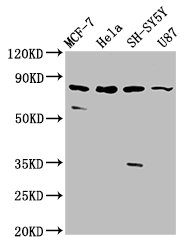 IL1RAPL1 Antibody - Positive Western Blot detected in MCF-7 whole cell lysate, Hela whole cell lysate, SH-SY5Y whole cell lysate, U87 whole cell lysate. All lanes: IL1RAPL1 antibody at 5.4 µg/ml Secondary Goat polyclonal to rabbit IgG at 1/50000 dilution. Predicted band size: 80 KDa. Observed band size: 80 KDa
