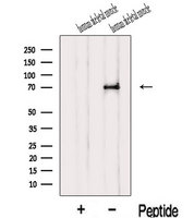IL1RAPL1 Antibody - Western blot analysis of extracts of human skeletal muscle tissue using IL1RAPL1 antibody. The lane on the left was treated with blocking peptide.
