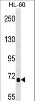 IL1RAPL2 Antibody - IL1RAPL2 Antibody western blot of HL-60 cell line lysates (35 ug/lane). The IL1RAPL2 antibody detected the IL1RAPL2 protein (arrow).