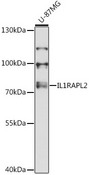 IL1RAPL2 Antibody - Western blot analysis of extracts of U-87MG cells, using IL1RAPL2 antibody at 1:3000 dilution. The secondary antibody used was an HRP Goat Anti-Rabbit IgG (H+L) at 1:10000 dilution. Lysates were loaded 25ug per lane and 3% nonfat dry milk in TBST was used for blocking. An ECL Kit was used for detection and the exposure time was 90s.