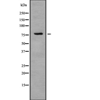 IL1RAPL2 Antibody - Western blot analysis IL-1R9 using COLO205 whole cells lysates