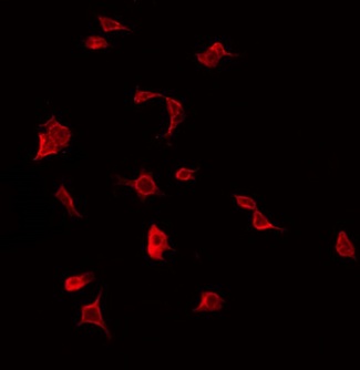 IL1RAPL2 Antibody - Staining COLO205 cells by IF/ICC. The samples were fixed with PFA and permeabilized in 0.1% Triton X-100, then blocked in 10% serum for 45 min at 25°C. The primary antibody was diluted at 1:200 and incubated with the sample for 1 hour at 37°C. An Alexa Fluor 594 conjugated goat anti-rabbit IgG (H+L) Ab, diluted at 1/600, was used as the secondary antibody.