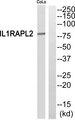 IL1RAPL2 Antibody - Western blot analysis of extracts from COLO205 cells, using IL1RAPL2 antibody.