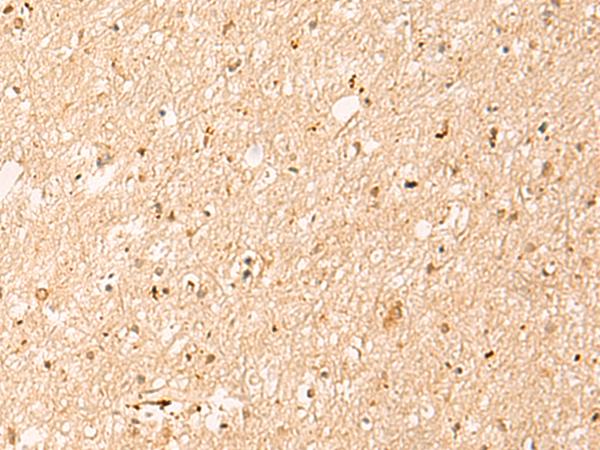 IL1RAPL2 Antibody - Immunohistochemistry of paraffin-embedded Human brain tissue  using IL1RAPL2 Polyclonal Antibody at dilution of 1:25(×200)
