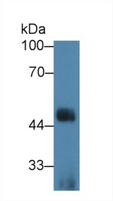 IL1RL1 Antibody - Western Blot; Sample: Human K562 cell lysate; Primary Ab: 3µg/ml Rabbit Anti-Human IL1RL1 Antibody Second Ab: 0.2µg/mL HRP-Linked Caprine Anti-Rabbit IgG Polyclonal Antibody