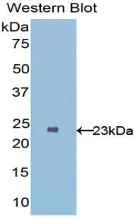 IL1RL1 Antibody - Western blot of recombinant IL1RL1 / ST2.  This image was taken for the unconjugated form of this product. Other forms have not been tested.