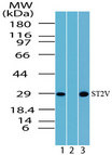 IL1RL1 Antibody - Western blot of ST2V in Daudi cell lysate in the 1) absence and 2) presence of immunizing peptide and 3) NIH 3T3 using Polyclonal Antibody to ST2V at 5 ug/ml and 3 ug/ml, respectively.