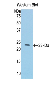 IL1RL1 Antibody - Western blot of recombinant IL1RL1 / ST2.  This image was taken for the unconjugated form of this product. Other forms have not been tested.