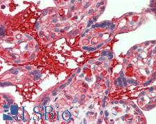 IL1RL1 Antibody - Human Placenta: Formalin-Fixed, Paraffin-Embedded (FFPE)