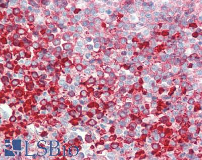 IL1RL1 Antibody - Human Spleen: Formalin-Fixed, Paraffin-Embedded (FFPE)