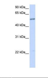 IL1RL1 Antibody - Fetal brain lysate. Antibody concentration: 1.0 ug/ml. Gel concentration: 12%.  This image was taken for the unconjugated form of this product. Other forms have not been tested.
