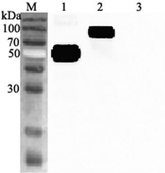 IL1RL1 Antibody - Western blot analysis using anti-ST2 (human), pAb at 1:2000 dilution. 1: Human soluble ST2 (FLAG-tagged). 2: Human soluble ST2 Fc-protein. 3: Human Vaspin (FLAG-tagged) (negative control).