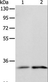 IL1RL1 Antibody - Western blot analysis of Human fetal kidney and intestine tissue, using IL1RL1 Polyclonal Antibody at dilution of 1:1100.