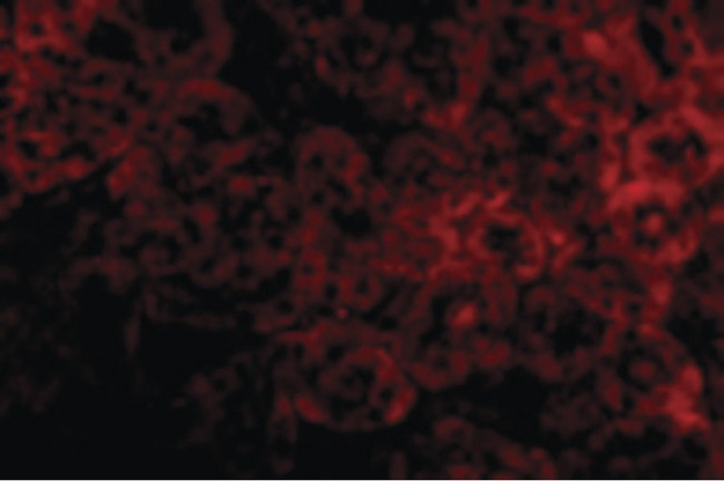 IL1RL1 Antibody - Immunofluorescence of ST2 in Mouse Kidney cells with ST2 antibody at 20 ug/ml.