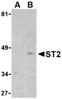 IL1RL1 Antibody - Western blot of ST2 in mouse kidney lysate with ST2 antibody at 1 ug/ml in the presence (lane A) or absence (lane B) of 1 ug blocking peptide.