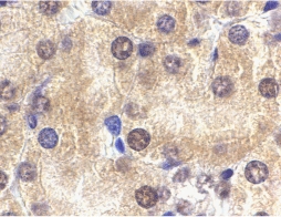 IL1RL1 Antibody - Immunohistochemistry of ST2 in mouse kidney tissue with ST2 antibody at 2 µg/ml.