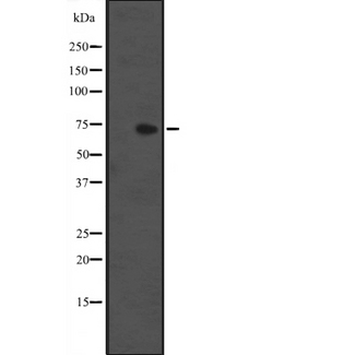 IL1RL1 Antibody - Western blot analysis of IL1RL1 expression in HEK293 cells. The lane on the left is treated with the antigen-specific peptide.
