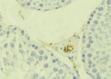 IL1RL1 Antibody - 1:100 staining mouse testis tissue by IHC-P. The sample was formaldehyde fixed and a heat mediated antigen retrieval step in citrate buffer was performed. The sample was then blocked and incubated with the antibody for 1.5 hours at 22°C. An HRP conjugated goat anti-rabbit antibody was used as the secondary.