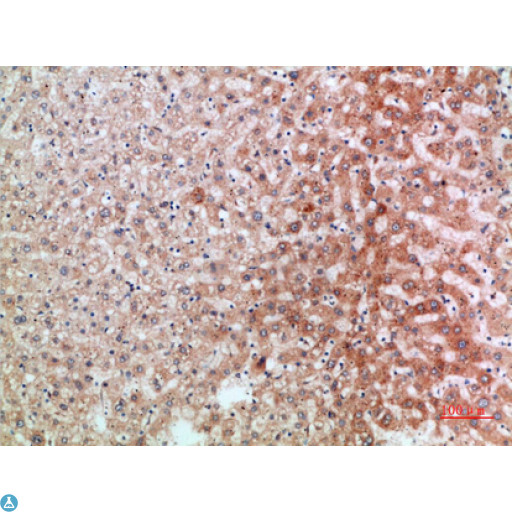 IL1RL1 Antibody - Immunohistochemical analysis of paraffin-embedded human-liver, antibody was diluted at 1:200.