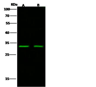 IL1RL1 Antibody - Anti-ST2 rabbit polyclonal antibody at 1:500 dilution. Lane A: Daudi Whole Cell Lysate. Lane B: K562 Whole Cell Lysate. Lysates/proteins at 30 ug per lane. Secondary: Goat Anti-Rabbit IgG H&L (Dylight 800) at 1/10000 dilution. Developed using the Odyssey technique. Performed under reducing conditions. Predicted band size: 29 kDa. Observed band size: 29 kDa.